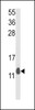 Western blot analysis of PEA-15 Antibody in mouse lung tissue lysates (35ug/lane)