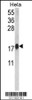 Western blot analysis of CALM1 Antibody in Hela cell line lysates (35ug/lane) (2ug/ml)