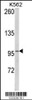 Western blot analysis of LPIN2 Antibody in K562 cell line lysates (35ug/lane) (2ug/ml)