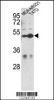 Western blot analysis of CEP55 Antibody in MDA-MB231, T47D cell line lysates (35ug/lane)