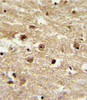 Formalin-fixed and paraffin-embedded human brain tissue with IGFBP2 Antibody, which was peroxidase-conjugated to the secondary antibody, followed by DAB staining.