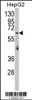 Western blot analysis of RARS2 Antibody in HepG2 cell line lysates (35ug/lane)