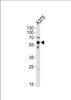 Western blot analysis of lysate from A375 cell line, using SRC Antibody (Y419) at 1:1000.