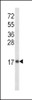 Western blot analysis of IL8 Antibody in MDA-MB468 cell line lysates (35ug/lane)