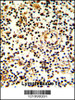 Formalin-fixed and paraffin-embedded human lymph with KLRD1 Antibody (N-term) , which was peroxidase-conjugated to the secondary antibody, followed by DAB staining.