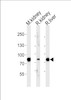 Western blot analysis of lysates from mousr kidney, rat kidney and liver tissue (from left to right) , using EHHADH Antibody at 1:1000 at each lane.