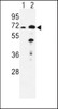 Western blot analysis of EHHADH Antibody in mouse liver (lane 1) , kidney (lane 2) tissue lysates (35ug/lane)