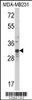 Western blot analysis of MLX Antibody in MDA-MB231 cell line lysates (35ug/lane)