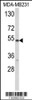 Western blot analysis of CYP2A13 Antibody in MDA-MB231 cell line lysates (35ug/lane)