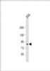 Western Blot at 1:1000 dilution + 293 whole cell lysate Lysates/proteins at 20 ug per lane.