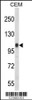 Western blot analysis of ITGB3 Antibody in CEM cell line lysates (35ug/lane) (2ug/ml)