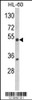 Western blot analysis of NR1I2 Antibody in HL-60 cell line lysates (35ug/lane)