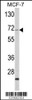 Western blot analysis of ZYG11A Antibody in MCF-7 cell line lysates (35ug/lane)