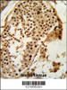 Formalin-fixed and paraffin-embedded human testis tissue reacted with PARD3 Antibody, which was peroxidase-conjugated to the secondary antibody, followed by DAB staining.