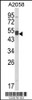 Western blot analysis of AGPAT3 Antibody in A2058 cell line lysates (35ug/lane)