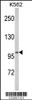 Western blot analysis of ATP12A Antibody in K562 cell line lysates (35ug/lane)