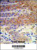 Formalin-fixed and paraffin-embedded human skin reacted with ATP12A Antibody, which was peroxidase-conjugated to the secondary antibody, followed by DAB staining.