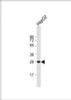 Western Blot at 1:1000 dilution + HepG2 whole cell lysate Lysates/proteins at 20 ug per lane.