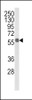 Western blot analysis of ALDH3B1 Antibody in MDA-MB231 cell line lysates (35ug/lane)