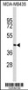 Western blot analysis of PHYH Antibody in MDA-MB435 cell line lysates (35ug/lane)