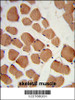 Formalin-fixed and paraffin-embedded human skeletal muscle reacted with PHYH2 Antibody, which was peroxidase-conjugated to the secondary antibody, followed by DAB staining.