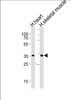 Western blot analysis of lysates from human heart and human skeletal muscle tissue lysate (from left to right) , using DIO2 Antibody at 1:1000 at each lane.