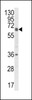 Western blot analysis of CYP2C18 Antibody in HL-60 cell line lysates (35ug/lane)