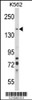 Western blot analysis of SORCS1 Antibody in K562 cell line lysates (35ug/lane)