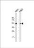 Western Blot at 1:1000 dilution Lane 1: Hela whole cell lysate Lane 2: K562 whole cell lysate Lysates/proteins at 20 ug per lane.