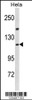 Western blot analysis of IPO11 Antibody in Hela cell line lysates (35ug/lane)