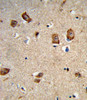 Formalin-fixed and paraffin-embedded human brain tissue reacted with ITGA1 Antibody, which was peroxidase-conjugated to the secondary antibody, followed by DAB staining.