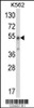 Western blot analysis of WDSUB1 Antibody in K562 cell line lysates (35ug/lane)