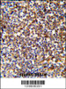 Formalin-fixed and paraffin-embedded human spleen tissue reacted with COTL1 Antibody, which was peroxidase-conjugated to the secondary antibody, followed by DAB staining.
