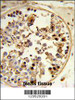 Formalin-fixed and paraffin-embedded human testis tissue reacted with ASPSCR1 Antibody, which was peroxidase-conjugated to the secondary antibody, followed by DAB staining.