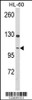 Western blot analysis of DNM3 Antibody in HL-60 cell line lysates (35ug/lane)