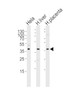 Western blot analysis of lysates from Hela cell line, human liver and placenta tissue lysate (from left to right) , using OLR1 Antibody at 1:1000 at each lane.