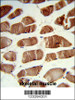 Formalin-fixed and paraffin-embedded human skeletal muscle reacted with CSRP2BP Antibody, which was peroxidase-conjugated to the secondary antibody, followed by DAB staining.