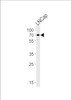 Western blot analysis of lysate from LNCap cell line, using CYP51A1 Antibody at 1:1000 at each lane.