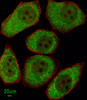 Immunofluorescent analysis of A549 cells, using ALOX12 Antibody. Antibody was diluted at 1:100 dilution. Alexa Fluor 488-conjugated goat anti-rabbit lgG at 1:400 dilution was used as the secondary antibody (green) . Cytoplasmic actin was counterstained with Dylight Fluor 554 (red) conjugated Phalloidin (red) .
