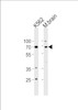 Western blot analysis in K562 cell line and mouse brain tissue lysates (35ug/lane) .