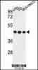 Western blot analysis of GPA33 Antibody in K562, 293, MDA-MB231 cell line lysates (35ug/lane)