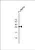 Western Blot at 1:1000 dilution + human plasma lysate Lysates/proteins at 20 ug per lane.