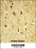 Formalin-fixed and paraffin-embedded human brain tissue reacted with ADAMTS18 Antibody, which was peroxidase-conjugated to the secondary antibody, followed by DAB staining.