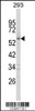Western blot analysis of FOXC1 Antibody in 293 cell line lysates (35ug/lane)