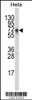 Western blot analysis of DTX1 Antibody in Hela cell line lysates (35ug/lane)