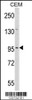 Western blot analysis of DZIP1 Antibody in CEM cell line lysates (35ug/lane)