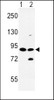 Western blot analysis of SLC8A1 Antibody in HL-60 (lane 1) , K562 (lane 2) cell line lysates (35ug/lane)