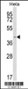 Western blot analysis of INSIG1 Antibody in Hela cell line lysates (35ug/lane)