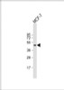 Western Blot at 1:1000 dilution + MCF-7 whole cell lysate Lysates/proteins at 20 ug per lane.