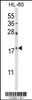 Western blot analysis of PIN1 Antibody in HL-60 cell line lysates (35ug/lane)